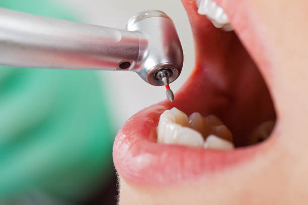Best Holiday Emergency Dentist in The Dalles, OR